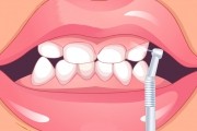 لعبة تنظيف الاسنان العاب دكتور الاسنان